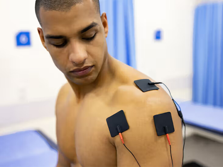 Electrical Stimulation Therapy